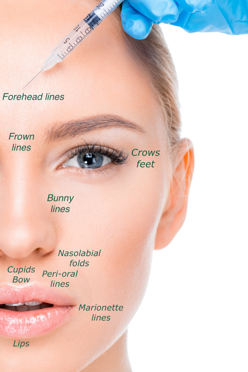 Anti- Wrinkle Treatment